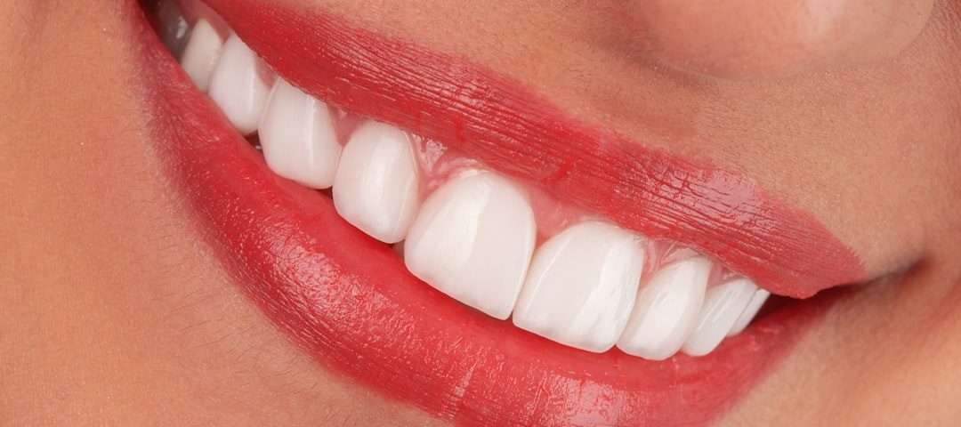 same day smile
