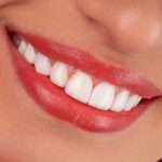 same day smile