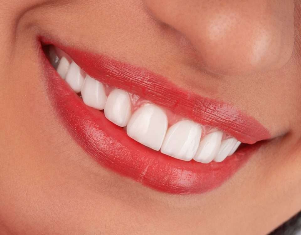 same day smile